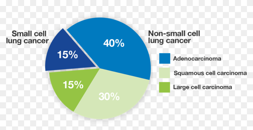 Lung Cancer Non Small Cell Symptoms, HD Png Download - 1024x538 ...